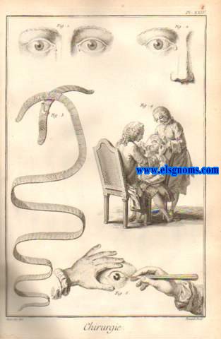 Recueil de planches, sur  les sciences, les arts libraux, et les arts mchaniques, avec leur explication. Chirurgie, contenant trente-neuf planches. Les Planches de Chirurgie sont desstines  reprsenter des instrumens, des appareils,& leur application dans les oprations chirurgiales. Chaque objet a sa description particulaire dans le Dictionnaire suivant la nomenclatureIl y a des instrumens communs  diffrentes oprations,& des maladies qui les exigent,les divers moyens qui y servent.Cet enchanement n'a pas permis de faire des Planches de Chirurgie un sistme li & qui offrit  une disposition aussi satisfaisante qu'il le faudroit pour un examen fuivi.